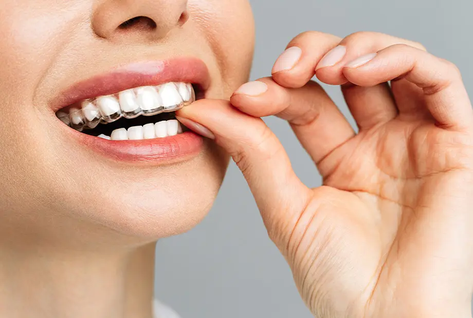 Patienten mit Veneers